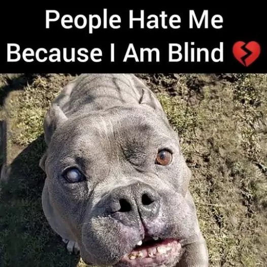 People hate me because I am blind but even I do not want that